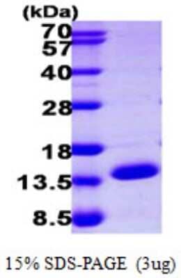 SDS-PAGE Recombinant Human ERH His Protein