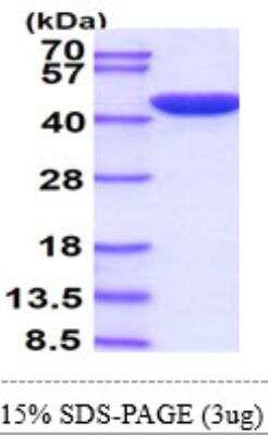 SDS-Page: Recombinant Human ERK2 Protein [NBP1-30309] - 15% SDS-Page (3ug)