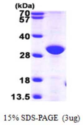 SDS-Page: Recombinant Human ERP27 Protein [NBP1-50913] - 15 % SDS-PAGE (3ug)