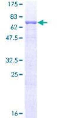 SDS-PAGE Recombinant Human ERR alpha/NR3B1 GST (N-Term) Protein