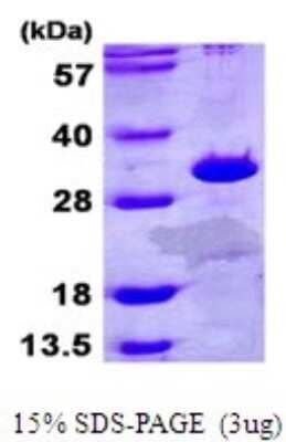 SDS-PAGE Recombinant Human ETFB His Protein