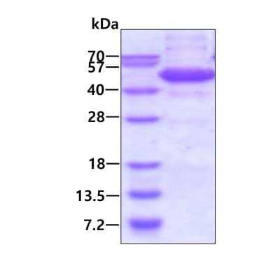 SDS-PAGE Recombinant Human ETS1 associated protein II His Protein