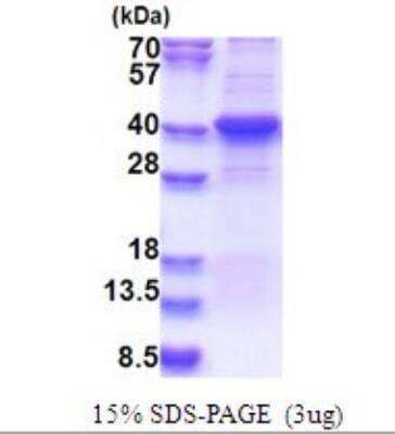 SDS-Page: Recombinant Human Endothelial Lipase Protein [NBP2-51639]