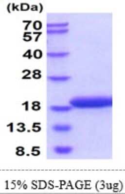 SDS-PAGE Recombinant Mouse gamma-Synuclein His Protein