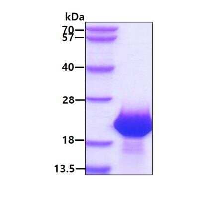 SDS-PAGE Recombinant Human FAM107B His Protein