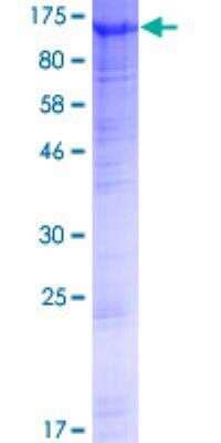 Recombinant Human FAM35A Protein [H00054537-P01] - 12.5% SDS-PAGE Stained with Coomassie Blue.