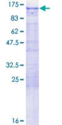 SDS-Page: Recombinant Human FE65 Protein [H00000322-P01] - 12.5% SDS-PAGE Stained with Coomassie Blue.