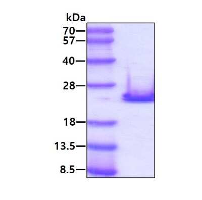 SDS-Page: Recombinant Human FGF-10 Protein [NBP1-78886] - 3ug by SDS-PAGE under reducing condition and visualized by coomassie blue stain.