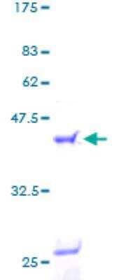 SDS-Page: Recombinant Human FLAP Protein [H00000241-P01] - 12.5% SDS-PAGE Stained with Coomassie Blue.