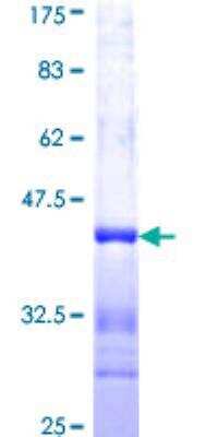 SDS-Page: Recombinant Human FMNL1 Protein [H00000752-Q01] - 12.5% SDS-PAGE Stained with Coomassie Blue.