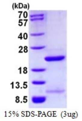 SDS-PAGE Recombinant Human FUBP1 His Protein