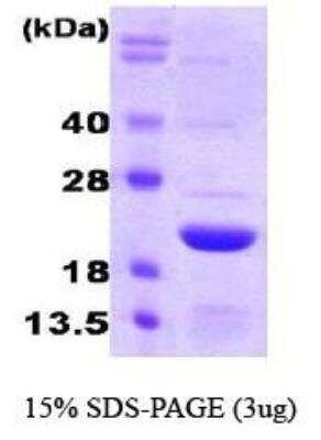 SDS-Page: Recombinant Human Ferritin Light Chain Protein [NBC1-18546] -  FTL1, 20kDa (175aa) with a purity of 90% by SDS - PAGE with a purity of 95% by SDS - PAGE