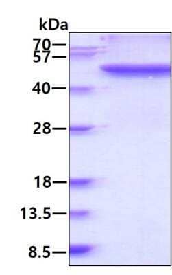 SDS-PAGE Recombinant Human Fibrinogen gamma chain His Protein