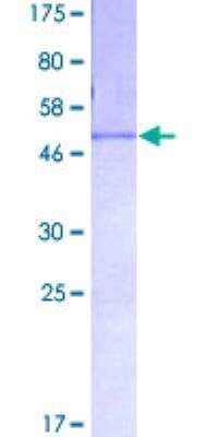 SDS-PAGE Recombinant Human Fibrinopeptide A GST (N-Term) Protein