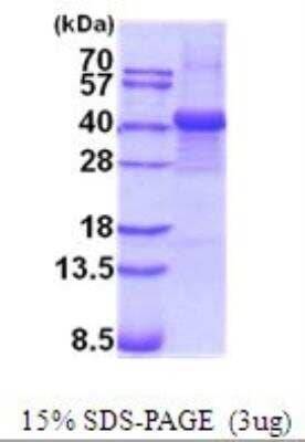 SDS-PAGE Recombinant Human Fibrinogen beta chain His Protein