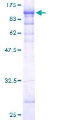 SDS-Page: Recombinant Human Filensin Protein [H00000631-P01] - 12.5% SDS-PAGE Stained with Coomassie Blue.
