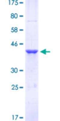 SDS-Page: Recombinant Human FoxM1 Protein [H00002305-Q02] - 12.5% SDS-PAGE Stained with Coomassie Blue.