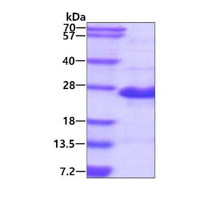 SDS-Page: Recombinant Human GAGE-2A His Protein [NBP2-23066] - 3ug by SDS-PAGE under reducing condition and visualized by coomassie blue stain.