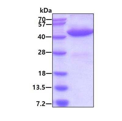 SDS-Page: Recombinant Human GALK1 His Protein [NBP1-45294] - 3ug by SDS-PAGE under reducing condition and visualized by coomassie blue stain.