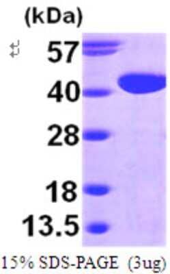 SDS-PAGE Recombinant Human GALM His Protein