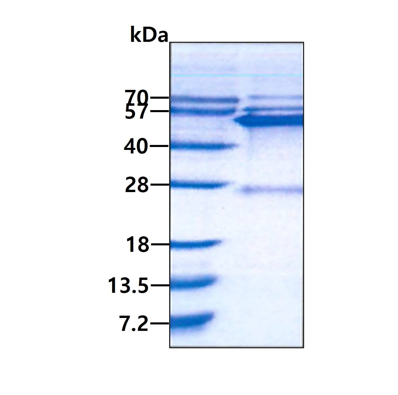 SDS-PAGE Recombinant Human GATM His Protein
