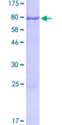 SDS-Page: Recombinant Human GCNF/NR6A1 Protein [H00002649-P01] - 12.5% SDS-PAGE Stained with Coomassie Blue.