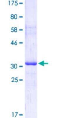 SDS-Page: Recombinant Human GGT1 Protein [H00002678-Q01] - 12.5% SDS-PAGE Stained with Coomassie Blue.