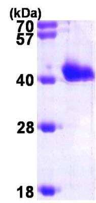 SDS-PAGE Recombinant Human GIPC1 His Protein