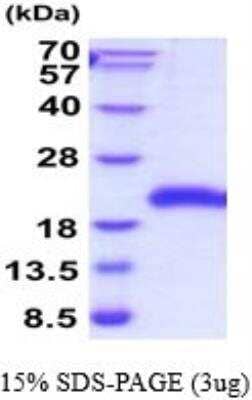 SDS-Page: Recombinant Human GITR/TNFRSF18 Protein [NBP2-52215]