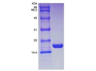 SDS-Page: Recombinant Human GMF-beta Protein [NBP2-34900]