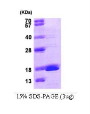SDS-Page: Recombinant Human GMFG Protein [NBC1-22612] - 3ug by SDS-PAGE under reducing condition and visualized by coomassie blue stain.