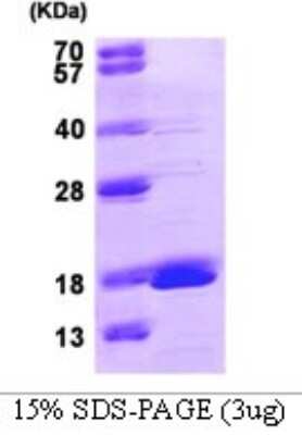 SDS-Page: Recombinant Human GMFG Protein [NBP1-98879] - 15% SDS-PAGE (3ug)