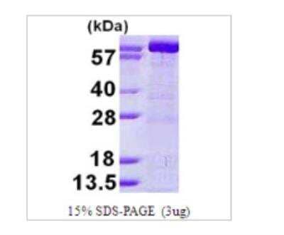 Recombinant Human GMPS Protein [NBP1-99114]