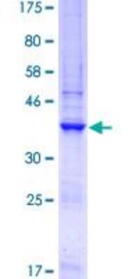 SDS-Page: Recombinant Human GNA14 Protein [H00009630-Q01] - 12.5% SDS-PAGE Stained with Coomassie Blue.