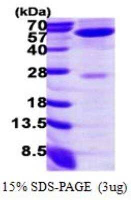 SDS-Page: Recombinant Human GPT Protein [NBP1-72522] - 15% SDS-PAGE (3ug)