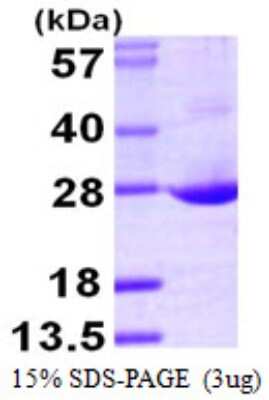 SDS-Page: Recombinant Human GRG (Groucho homolog) Protein [NBP1-51027] - 15 % SDS-PAGE (3ug)