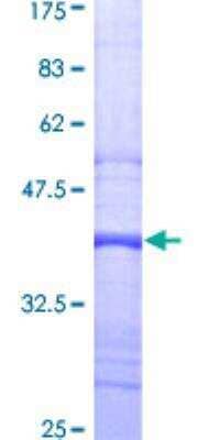 SDS-Page: Recombinant Human GRK3 Protein [H00000157-Q01] - 12.5% SDS-PAGE Stained with Coomassie Blue.