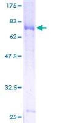 SDS-Page: Recombinant Human GSDMDC1 Protein [H00079792-P01] - 12.5% SDS-PAGE Stained with Coomassie Blue.