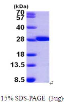 SDS-Page: Recombinant Human GSTM2 Protein [NBP1-50850] - 15 % SDS-PAGE (3ug)