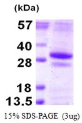 SDS-Page: Recombinant Human GSTO2 Protein [NBP1-99012] - 15% SDS-PAGE (3ug)