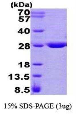 SDS-Page: Recombinant Human GSTZ1 Protein [NBP1-40410]