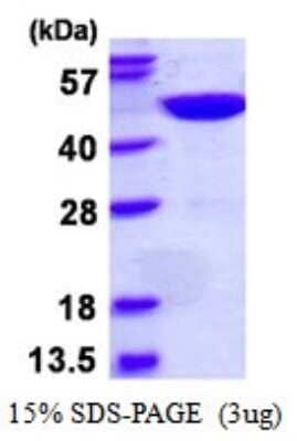 SDS-Page: Recombinant Human GTPBP9 Protein [NBP1-98872] - 15% SDS-PAGE (3ug)