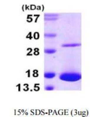 SDS-Page: Recombinant Human Galectin-10 Protein [NBP1-51096]