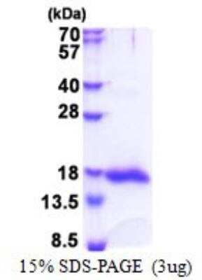 SDS-Page: Recombinant Human Galectin 13 Protein [NBP2-23189]