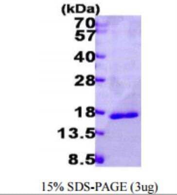 Recombinant Human Galectin-14/LGALS14 Protein [NBP1-50882]