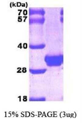 SDS-Page: Recombinant Human Galectin-3 Protein [NBP1-30277] - Galectin-3, 28.3 kDa (270aa), confirmed by MALDI-TOF with a purity of 95% by SDS - PAGE
