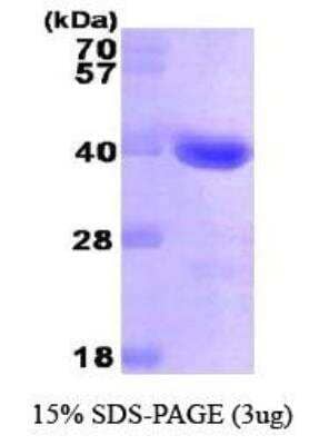 SDS-Page: Recombinant Human Galectin-4 Protein [NBP1-30270] - Galectin- 4, 38.1 kDa (343aa), confirmed by MALDI-TOF  with a purity of 95% by SDS - PAGE