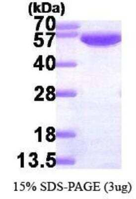 SDS-PAGE Recombinant Human Glucose 6 phosphate isomerase His Protein