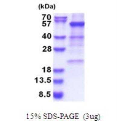 SDS-PAGE Recombinant Human Glutamate Dehydrogenase His Protein