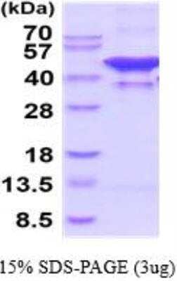 SDS-PAGE Recombinant Human Glutamine Synthetase His Protein